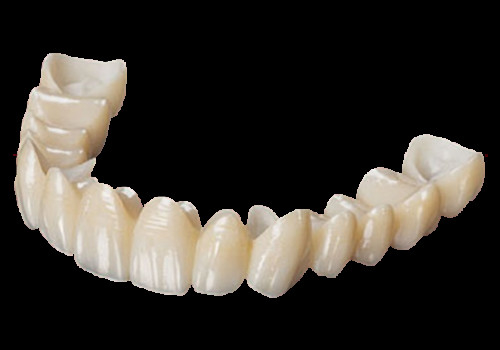 สวยงามสูง ครอบคลุมครบ Zirconia Crown