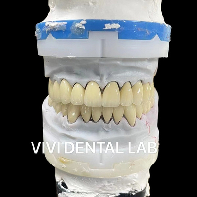 ดิจิตอล CAD CAM ศูนย์ปฏิบัติการฟัน ราชมงคลกระจ่างใส ราชมงคลซิรคอนิยาชั้น