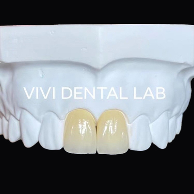 รางวัลห้องปฏิบัติการฟันแม่น Ivoclar Esthetic รางวัล Zirconia ดูธรรมชาติ