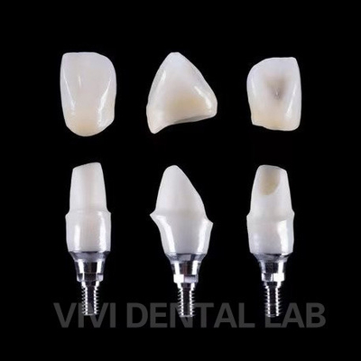 การปลูกฟัน Tibase Zirconia Abutment Titanium ความแม่นยําที่กําหนดเอง