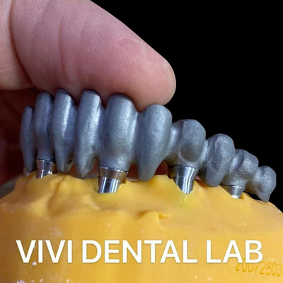 พิมพ์ PFM Bridge Over Multi Unit Abutments จากห้องปฏิบัติการทันตศาสตร์จีน