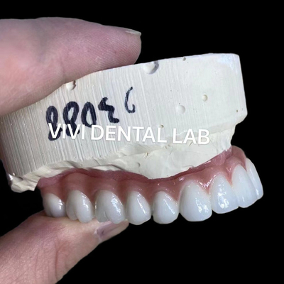 สีธรรมชาติ ดูสวยงาม สกรูรักษา Zirconia การปลูกมงกุฎนานนาน
