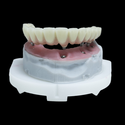 ทั้งหมดใน 4 PFM ปลูกฟันมงคลไทเทเนียม Zirconia ทั้งหมดใน 6 การฟื้นฟู