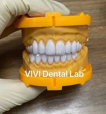 Ivoclar Emax Laminate Veneers ความโปร่งใสสูง ห้องปฏิบัติการฟันจีน