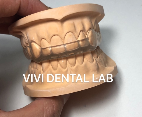 คืนทันตแพทย์ ป้องกันปาก Occlusal สปริง Ekodent ดีฟิต ความสวยงามสูง