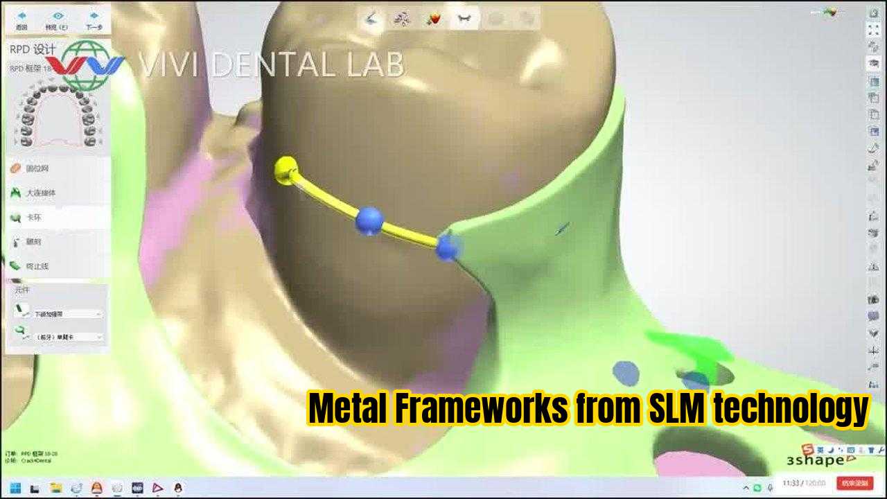 จีน VIVI DENTAI LABORATORY รับรอง