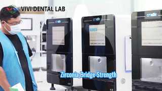สะพานเซอร์โคเนีย Strong Esthetic VIVI Dental Lab